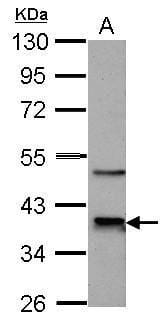 Sample (30 µg of whole cell lysate)  HL-60 10% SDS PAGE #35444 diluted at 1: 1000