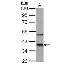 CDK9 Antibody from Signalway Antibody (35444) - Antibodies.com