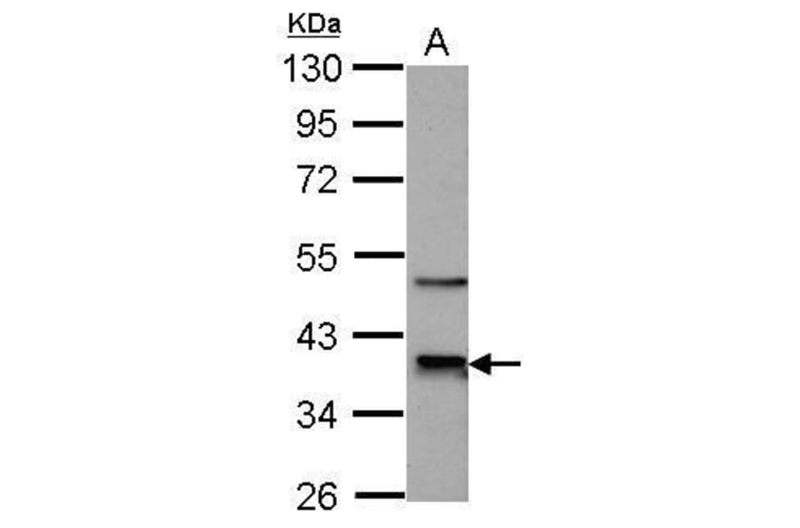 CDK9 Antibody from Signalway Antibody (35444) - Antibodies.com
