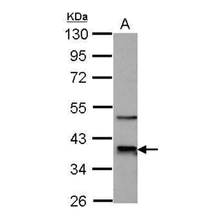 CDK9 Antibody from Signalway Antibody (35444) - Antibodies.com