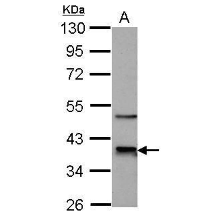 CDK9 Antibody from Signalway Antibody (35444) - Antibodies.com