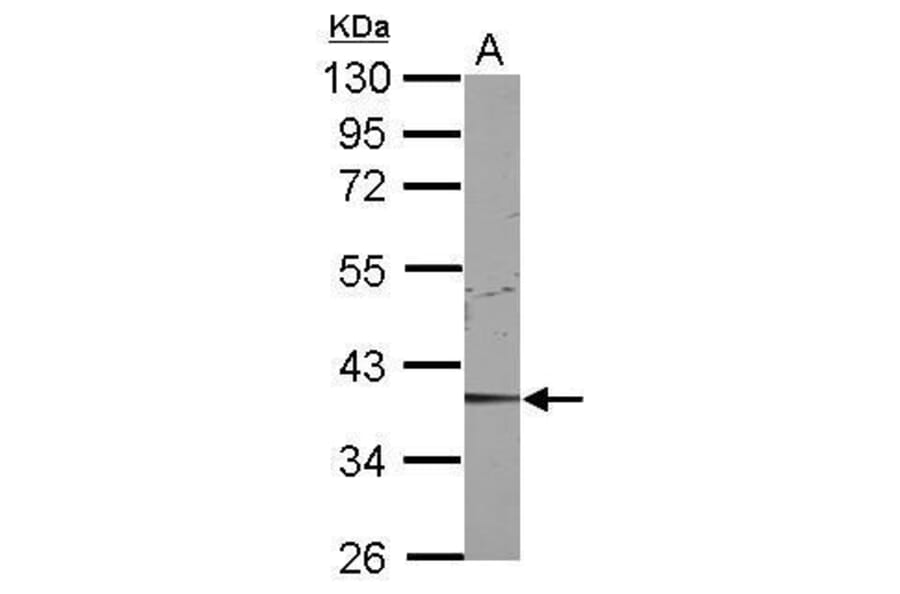 CDK9 Antibody from Signalway Antibody (35444) - Antibodies.com