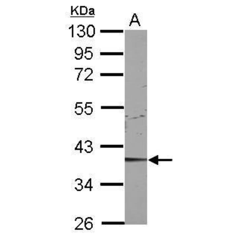 CDK9 Antibody from Signalway Antibody (35444) - Antibodies.com