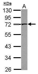 Sample (30 µg of whole cell lysate)  NT2D1 10% SDS PAGE #35447 diluted at 1: 500