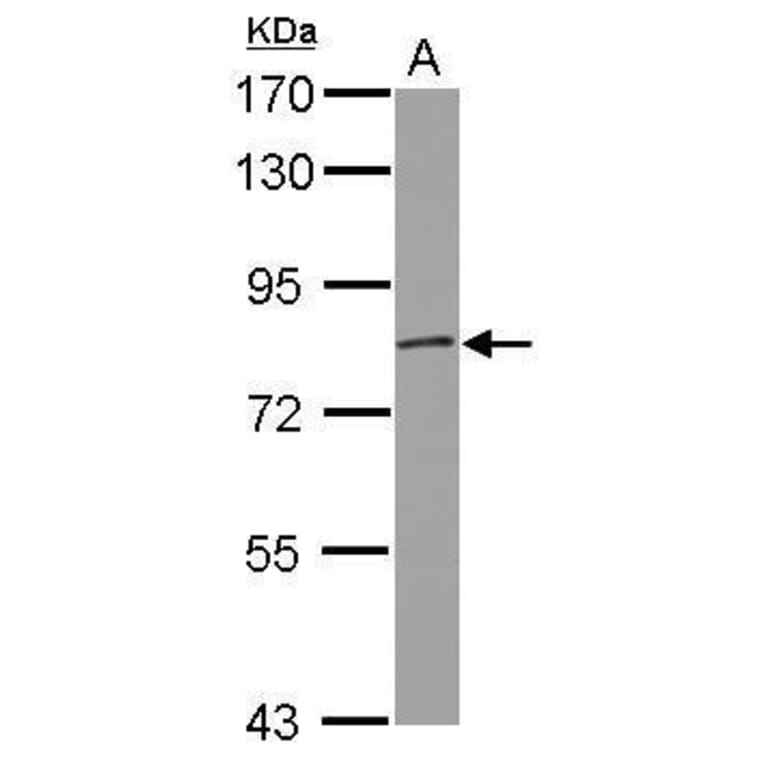 GRK2 Antibody from Signalway Antibody (35449) - Antibodies.com