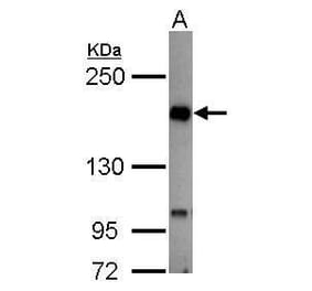 TIE2 Antibody from Signalway Antibody (35450) - Antibodies.com