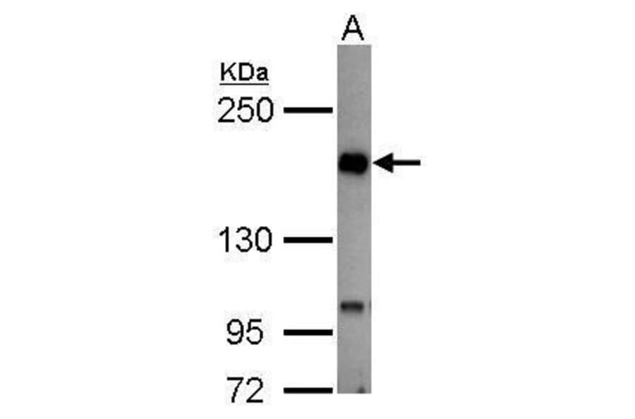 TIE2 Antibody from Signalway Antibody (35450) - Antibodies.com