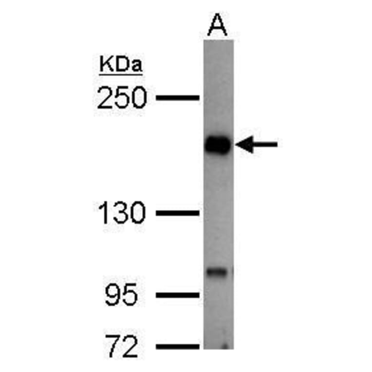TIE2 Antibody from Signalway Antibody (35450) - Antibodies.com