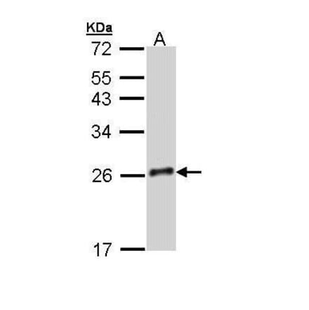 GH-V Antibody from Signalway Antibody (35477) - Antibodies.com