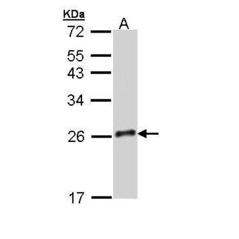 GH-V Antibody from Signalway Antibody (35477) - Antibodies.com