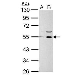 Wnt1Wnt1 Antibody from Signalway Antibody (35481) - Antibodies.com