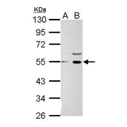 Wnt1Wnt1 Antibody from Signalway Antibody (35481) - Antibodies.com