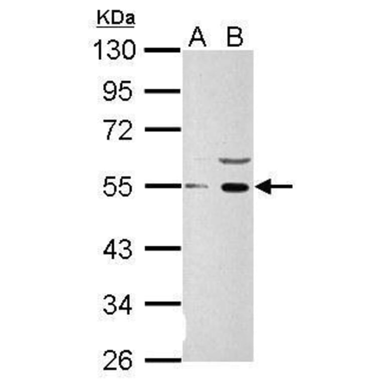 Wnt1Wnt1 Antibody from Signalway Antibody (35481) - Antibodies.com