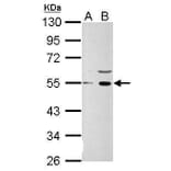 Wnt1Wnt1 Antibody from Signalway Antibody (35481) - Antibodies.com