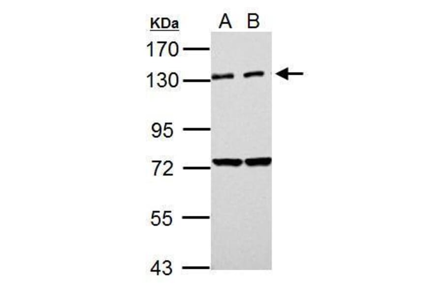 PKN2 Antibody from Signalway Antibody (35490) - Antibodies.com