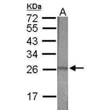 Western blot - CD34 Antibody from Signalway Antibody (35494) - Antibodies.com