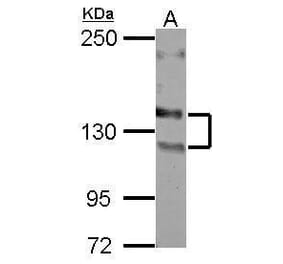 NCAM Antibody from Signalway Antibody (35496) - Antibodies.com