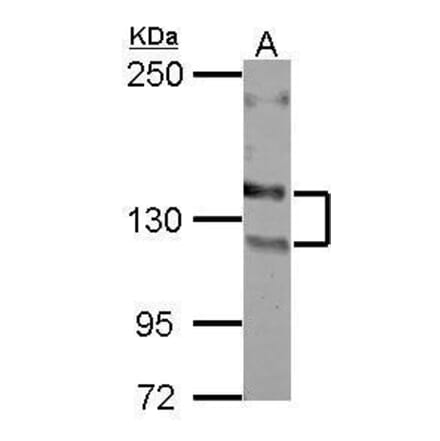 NCAM Antibody from Signalway Antibody (35496) - Antibodies.com