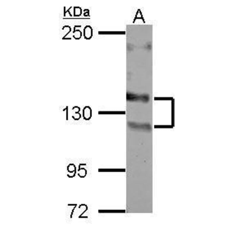 NCAM Antibody from Signalway Antibody (35496) - Antibodies.com