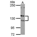 NCAM Antibody from Signalway Antibody (35496) - Antibodies.com