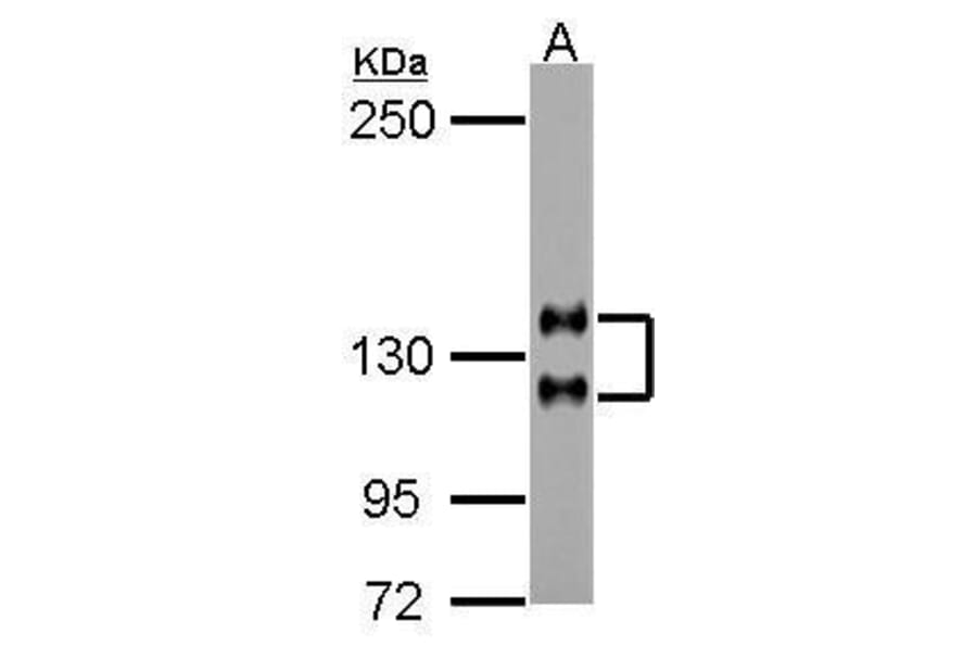 NCAM Antibody from Signalway Antibody (35496) - Antibodies.com