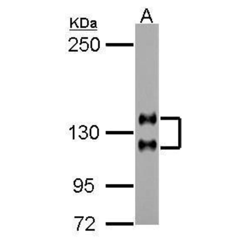 NCAM Antibody from Signalway Antibody (35496) - Antibodies.com