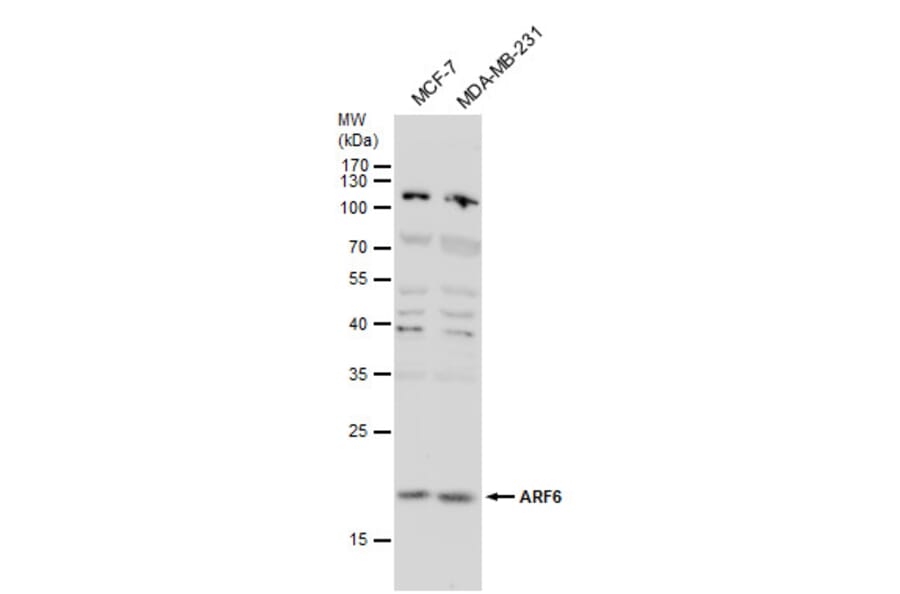 ARF6 Antibody from Signalway Antibody (35514) - Antibodies.com
