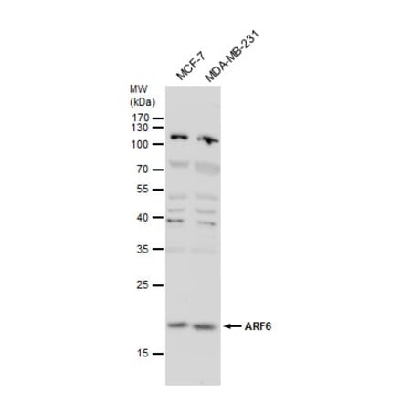 ARF6 Antibody from Signalway Antibody (35514) - Antibodies.com
