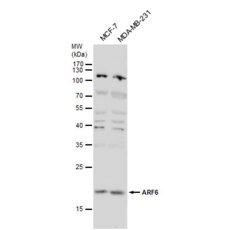 ARF6 Antibody from Signalway Antibody (35514) - Antibodies.com