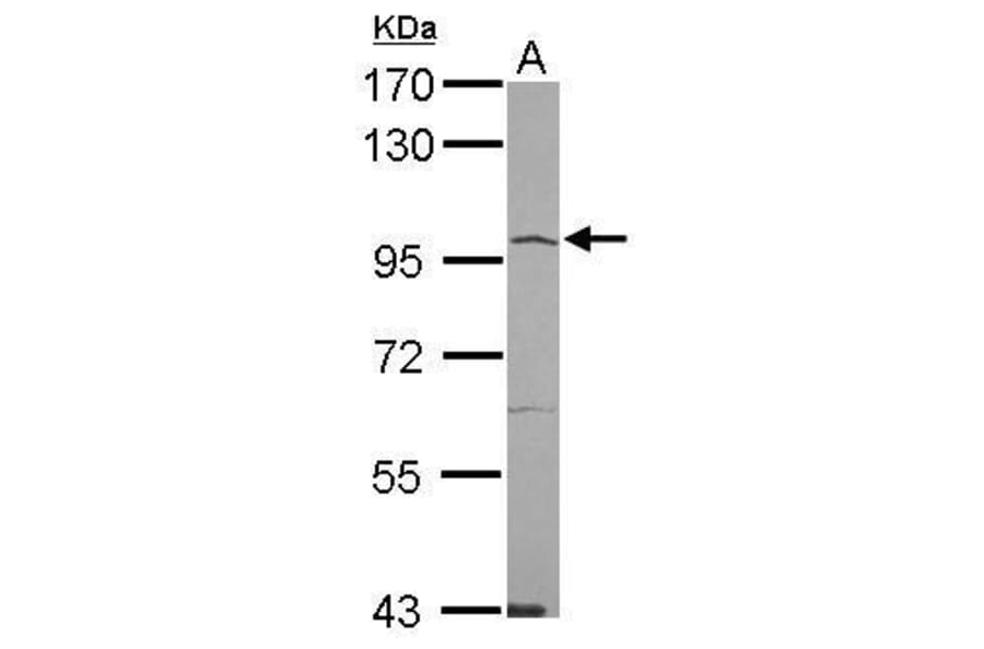 ACE2 Antibody from Signalway Antibody (35524) - Antibodies.com