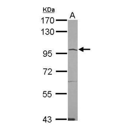 ACE2 Antibody from Signalway Antibody (35524) - Antibodies.com