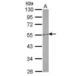 CETP Antibody from Signalway Antibody (35526) - Antibodies.com