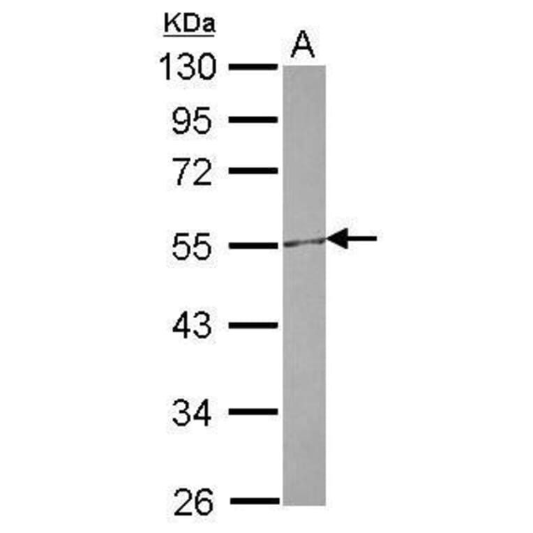 CETP Antibody from Signalway Antibody (35526) - Antibodies.com