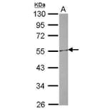 CETP Antibody from Signalway Antibody (35526) - Antibodies.com