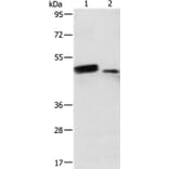 RARB Antibody from Signalway Antibody (35543) - Antibodies.com