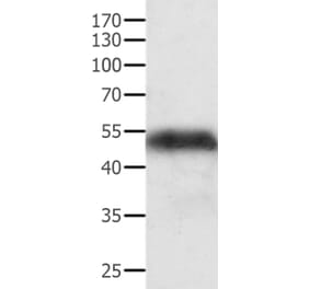 ACPP Antibody from Signalway Antibody (35560) - Antibodies.com