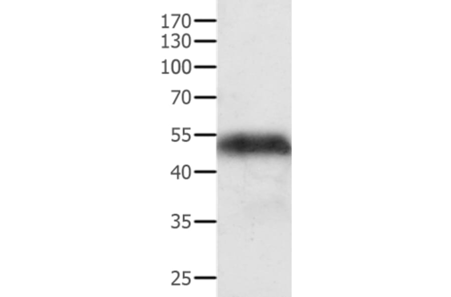ACPP Antibody from Signalway Antibody (35560) - Antibodies.com