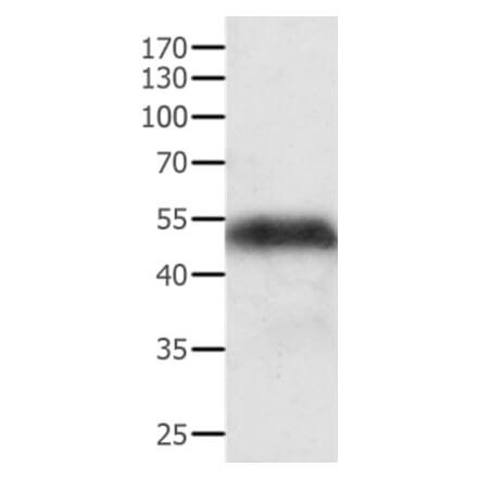 ACPP Antibody from Signalway Antibody (35560) - Antibodies.com