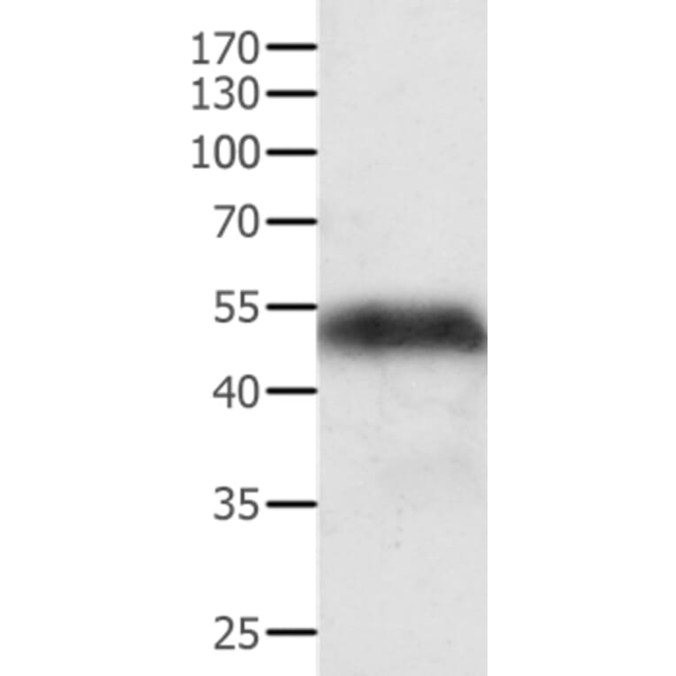 ACPP Antibody from Signalway Antibody (35560) - Antibodies.com