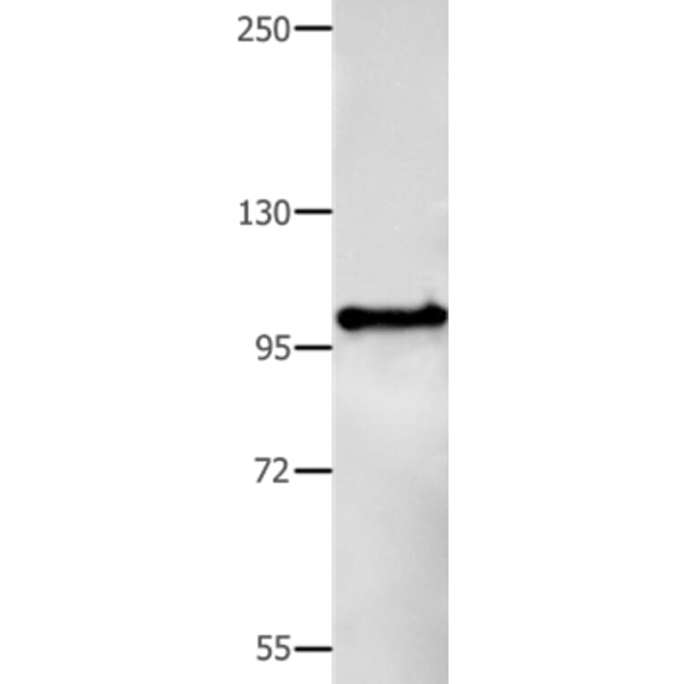 BCOR Antibody from Signalway Antibody (35594) - Antibodies.com