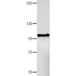 BCOR Antibody from Signalway Antibody (35594) - Antibodies.com