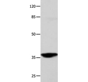 CTSG Antibody from Signalway Antibody (35667) - Antibodies.com