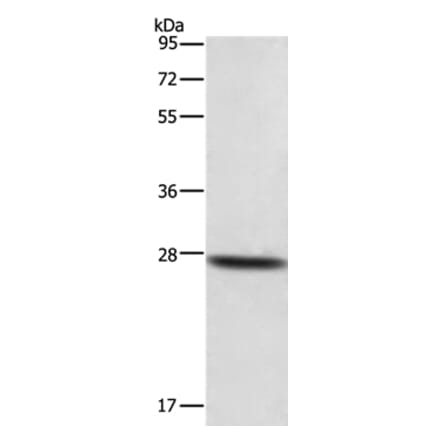 DKK2 Antibody from Signalway Antibody (35714) - Antibodies.com