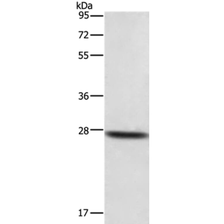 DKK2 Antibody from Signalway Antibody (35714) - Antibodies.com