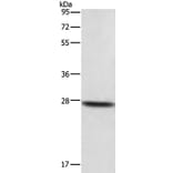 DKK2 Antibody from Signalway Antibody (35714) - Antibodies.com