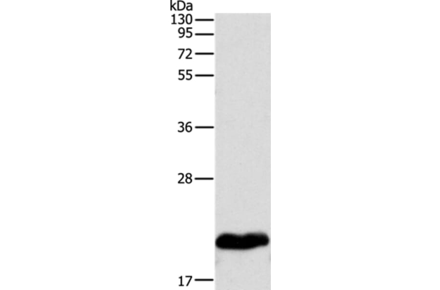 MYL2 Antibody from Signalway Antibody (35826) - Antibodies.com