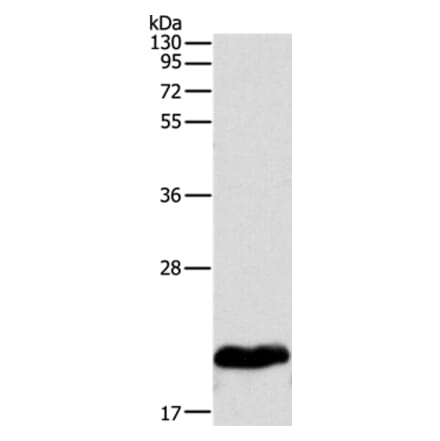 MYL2 Antibody from Signalway Antibody (35826) - Antibodies.com
