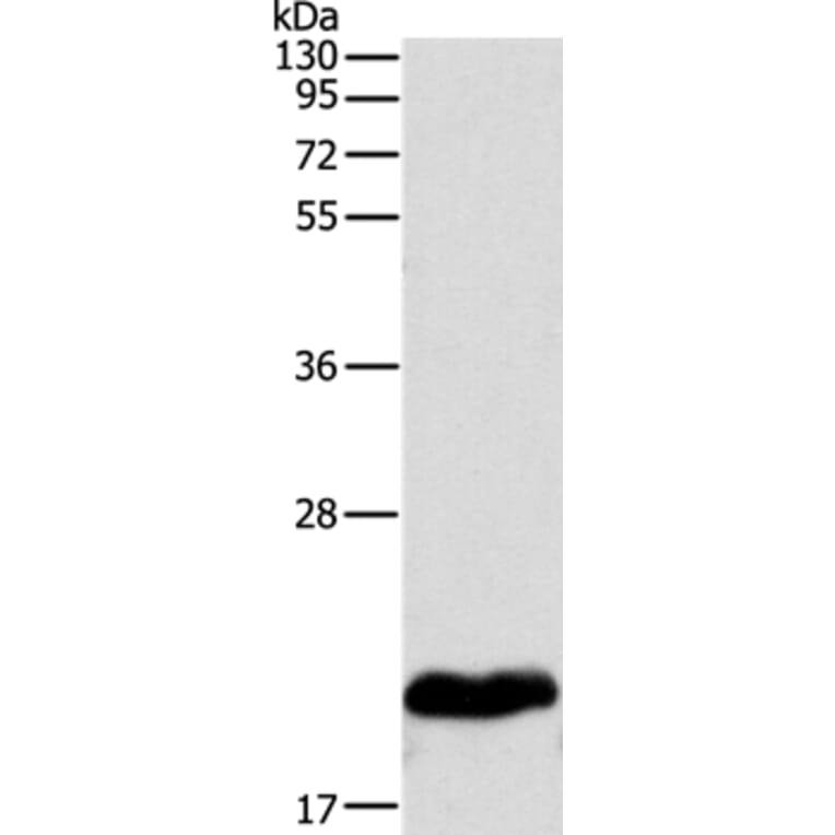 MYL2 Antibody from Signalway Antibody (35826) - Antibodies.com