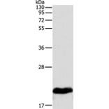 MYL2 Antibody from Signalway Antibody (35826) - Antibodies.com
