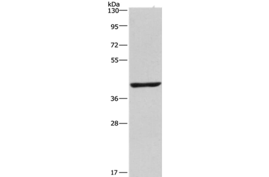 NME7 Antibody from Signalway Antibody (35840) - Antibodies.com